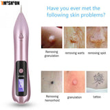 Laser Dark Spot Removal Pen